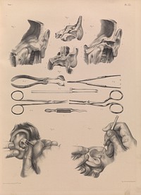 Plate 13. Surgical anatomy of the ear