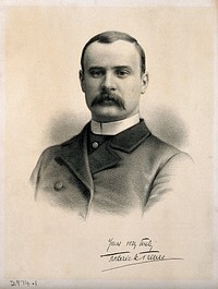Sir Frederick Treves. Lithograph, 1884.