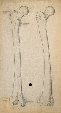 Right femur (thigh-bone), front view: two figures. Pencil drawing, ca. 1804.