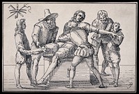 Two surgeons amputating the leg and arm of the same patient who is being restrained by assistants. Pen drawing after an engraving, 1597.