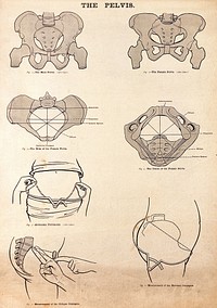 The pelvis in pregnancy. Lithograph after W. F. Victor Bonney.