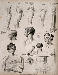 Diagrams illustrating: five bandaged legs (three with different sorts of splints), two heads showing veins, a bandaged head, a bandaged torso, a recepticle with body for curing shoulder dislocations and an eye operation. Line engraving by W.H. Lizars, 1830.