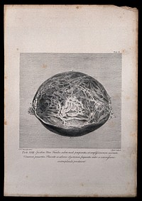 Dissection of the pregnant uterus at eight months, showing the fundus. Copperplate engraving by Menil after I.V. Rymsdyk, 1774, reprinted 1851.