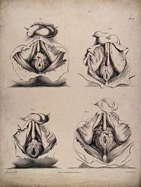 The circulatory system: dissections of the male reproductive system and anal area, with the arteries  indicated in red. Coloured lithograph by J. Maclise, 1841/1844.