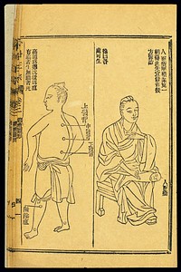 Chinese woodcut: Abscesses -- 'human face sores', etc.