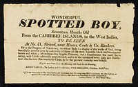 Wonderful spotted boy : seventeen months old from the Caribbee islands, in the West Indies : to be seen at no.41, Strand, near Messrs. Couts & Co. bankers : he is the progeny of negroes, on whose body is a display of the works of God, being beautifully covered by a diversity of spots of the most beautiful black and transparent brown and white.