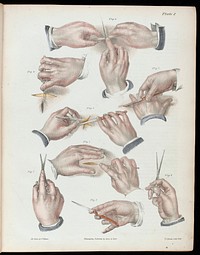 A treatise on operative surgery comprising a description of the various processes of the art, including all the new operations; exhibiting the state of surgical science in its present advanced condition; with eighty plates, containing four hundred and eighty-six separate illustrations. Second edition, revised and enlarged / by Joseph Pancoast.