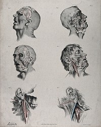 The circulatory system: six dissections of the male face and neck, with arteries, blood vessels and veins indicated in red and blue. Coloured lithograph by J. Maclise, 1841/1844.