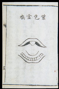 C18 Chinese woodcut: Purple deficiency throat