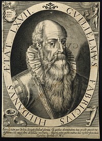 Guglielmus Fabricius of Hilden. Line engraving.