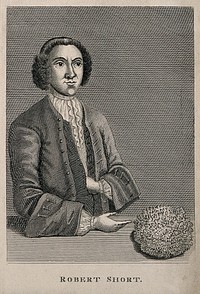 Robert Short, who had a bladder-stone removed which was eight inches in circumference. Engraving, 1820.