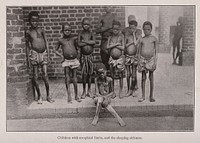 A group of children suffering from sleeping sickness. Reproduction of a photograph.