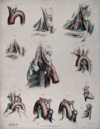 The circulatory system: dissections showing the aortic arch , arteries and veins of the neck, with arteries and veins indicated in red and blue. Coloured lithograph by J. Maclise, 1841/1844.