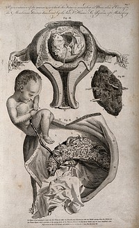 A cross-section of a uterus illustrating how the foetus is fed internally by the mother. Engraving by W. Taylor, 1791, after F. Birnie after W. Smellie.