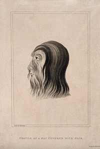 Shwe-Maong, a man in Burma whose head and face are covered with hair. Aquatint by J.H. Clark after W.E. Reid.