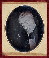 An elderly man after his death. Photograph, 1840/1855.