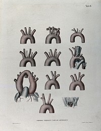 The aortic arch and the arteries of the neck: eleven figures. Coloured lithograph by J. Roux, 1822.