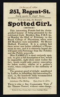 251, Regent-St. nearly opposite the Argyll Rooms : to be seen daily, the beautiful Spotted Girl ... Miss Fabian is most curiously spotted ...