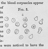 The urine and its derangements : with the application of physiological chemistry to the diagnosis and treatment of constitutional, as well as local diseases ... / by George Harley.