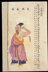 C19 Chinese MS moxibustion point chart: Underarm odour point