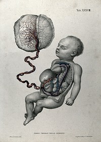 A baby, with thorax and abdomen dissected, attached by umbilical cord to the placenta, with the arteries, blood vessels and veins indicated in red. Coloured lithograph by J. Roux, 1822.