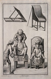 Surgery: above, a chair-bedstead and a patient-dossier; below, a man and a child seated on the chair-bedstead. Engraving by B.L. Prevost after Louis-Jacques Goussier.
