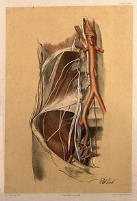 Dissection of the abdomen of a man, showing the arteries, blood vessels and muscles. Colour lithograph by G.H. Ford, 1866.