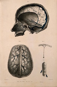 Veins of the brain (cerebral sinuses) and of the inside of the skull. Coloured lithograph by William Fairland, 1837, after J. Walsh after W.J.E. Wilson.