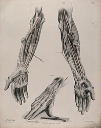 The circulatory system: dissections of the arm and hand, with the arteries indicated in red and surgical instruments shown below. Coloured lithograph by J. Maclise, 1841/1844.