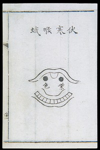 C18 Chinese woodcut: Lurking-cold tonsillitis