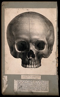 Skull of a soldier: frontal view. Lithograph, 1835.