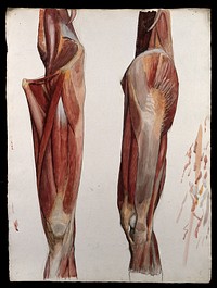 Two dissections showing the muscles of the thigh, hip, pelvis and knee. Watercolour by J.C. Zeller, ca. 1833.