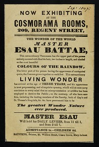 Now exhibiting at the Cosmorama Rooms, 209, Regent Street : the wonder of the world, Master Esau Battae.