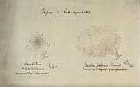 Vincent's angina: microscopic views of spirochetes (left) and bacillus fusiformis (right). Drawing by Jean Hyacinthe Vincent.