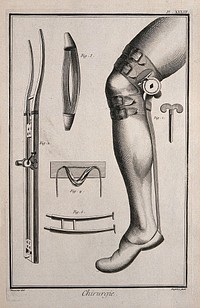 Surgery: surgical instruments for the correction of dislocated limbs. Engraving with etching by A.J. Defehrt after L.-J. Goussier.