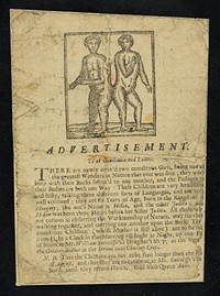 Advertisement : To all gentlemen and ladies . There are newly arriv'd two monstrous girls, being one of the greatest wonders in nature that was ever seen ; they were born with their backs fasten'd to one another, and the passages of their bodies are both one way ...