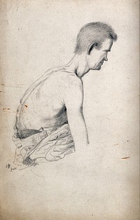A male with naked torso: side view of right shoulder. Drawing attributed to H.W. Berend, c. 1856.