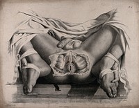 The circulatory system: dissection of the anal area of a man, with the arteries  indicated in red. Coloured lithograph by J. Maclise, 1841/1844.