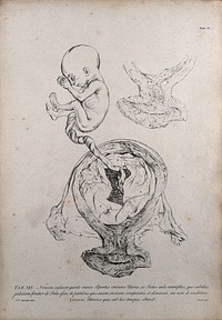 Dissection of the pregnant uterus at five months, showing the foetus removed and the umbilical cord still attached, with a detail showing the cervix. Copperplate engraving by Manil after J.V. Rymsdyk, 1774, reprinted 1851.