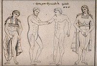 Top, three bandaged heads; centre, a naked surgeon sets the arm of a naked patient both flanked by bandaged women; bottom, bandaged bodies and limbs. Engraving.