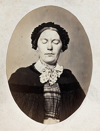A woman's head and shoulders; her eyes are closed and her mouth shows a slight grimace. Photograph by L. Haase after H.W. Berend, 1864.