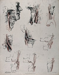 The circulatory system: dissections of the neck and jaw of a man, with arteries and blood vessels indicated in red. Coloured lithograph by J. Maclise, 1841/1844.