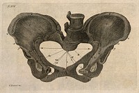 The bones of the pelvis. Engraving by G. Bartoli.