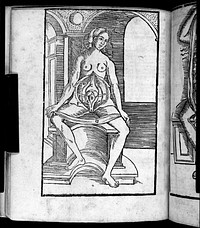 Anatomia Mundini, ad vetustissimorum, erundemque [sic] aliquot manu scriptorum, codicum fidem collata, justoque suo ordini restituta / Per Joannem Dryandrum.
