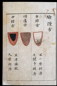 C14 Chinese tongue diagnosis chart