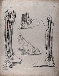 The circulatory system: dissections of the foot, lower leg and ankle, with arteries  indicated in red. Coloured lithograph by J. Maclise, 1841/1844.