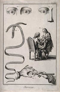 A sheet showing eye defects, apparatus and an examination. Engraving by Prévost, 1763, after L.-J. Goussier.