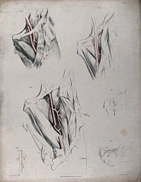 The circulatory system: dissections of the groin and thigh of a man , with the arteries indicated in red. Coloured lithograph by J. Maclise, 1841/1844.