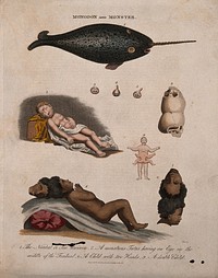 Deformed infants; and a narwhal. Coloured engraving by J. Pass, 1817.