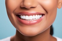 Women showing beautiful white smile teeth skin blue.